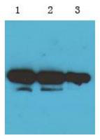 GST-tag（MB10）小鼠单克隆抗体