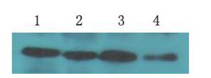 植物β-肌动蛋白（MD1）小鼠单克隆抗体