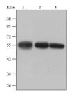 β-tubulin （MG7 ）Mouse MonoclonalAntibody