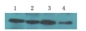 Plant β-actin （MD1 ）Mouse MonoclonalAntibody