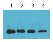 Histone H3.1 （MG4 ）Mouse MonoclonalAntibody